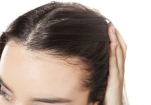 Metro MediSpa PRP for hair loss